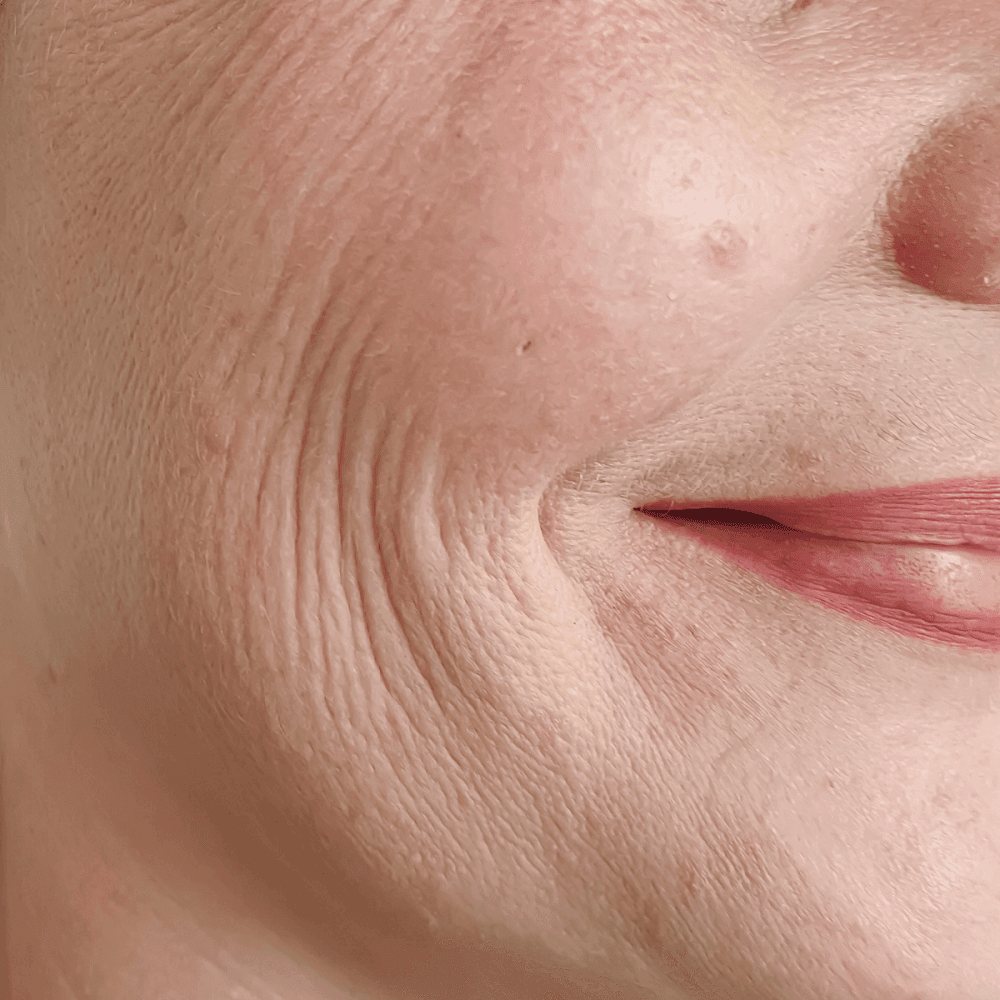 Close-up of facial skin with fine lines around the mouth under soft light during a skincare treatment at Hotel X Toronto